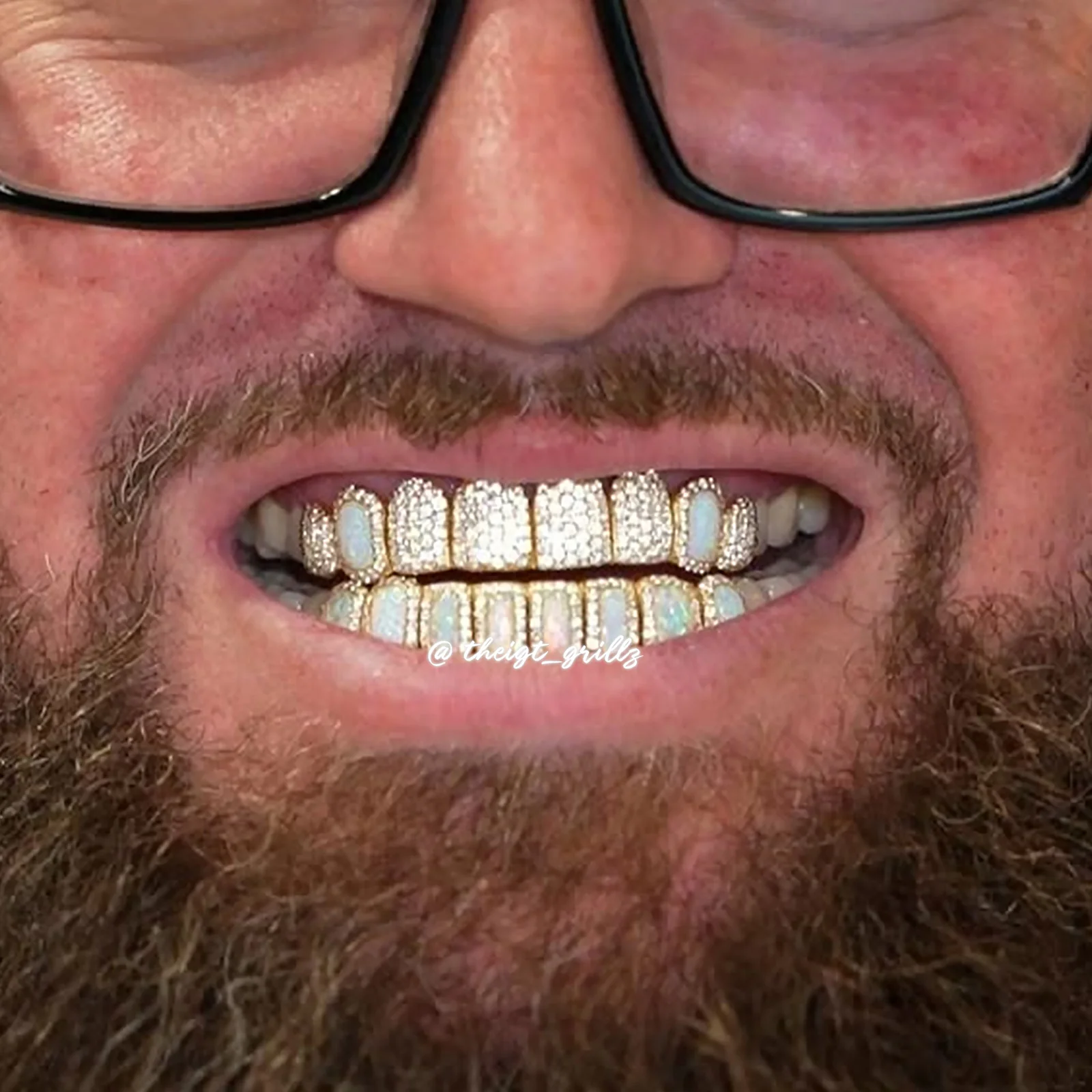 Pave Setting Opal Diamond Grillz - Image 9