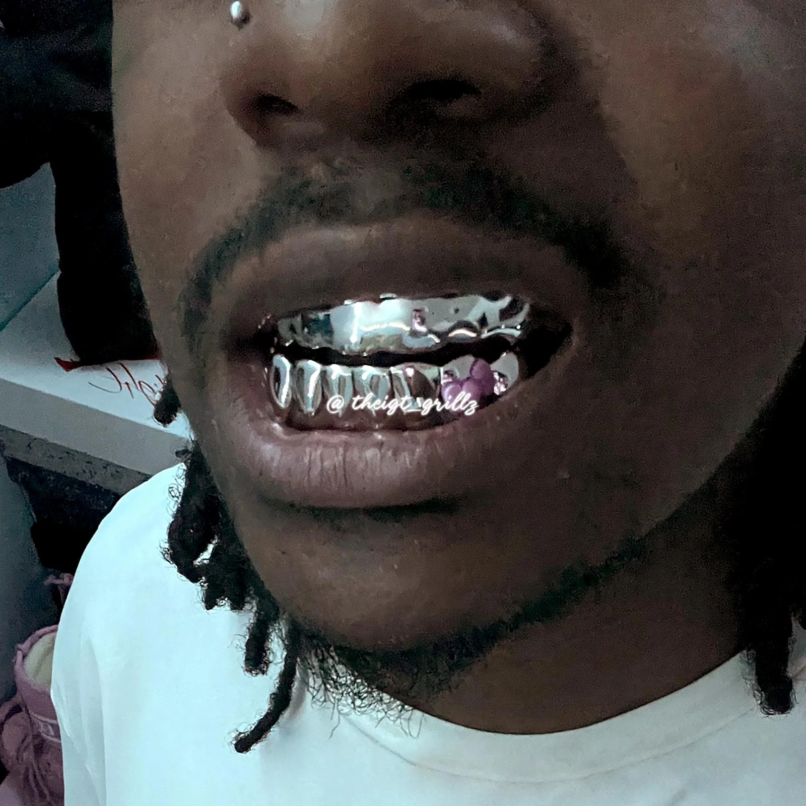 Pink Bow Grillz - Image 7