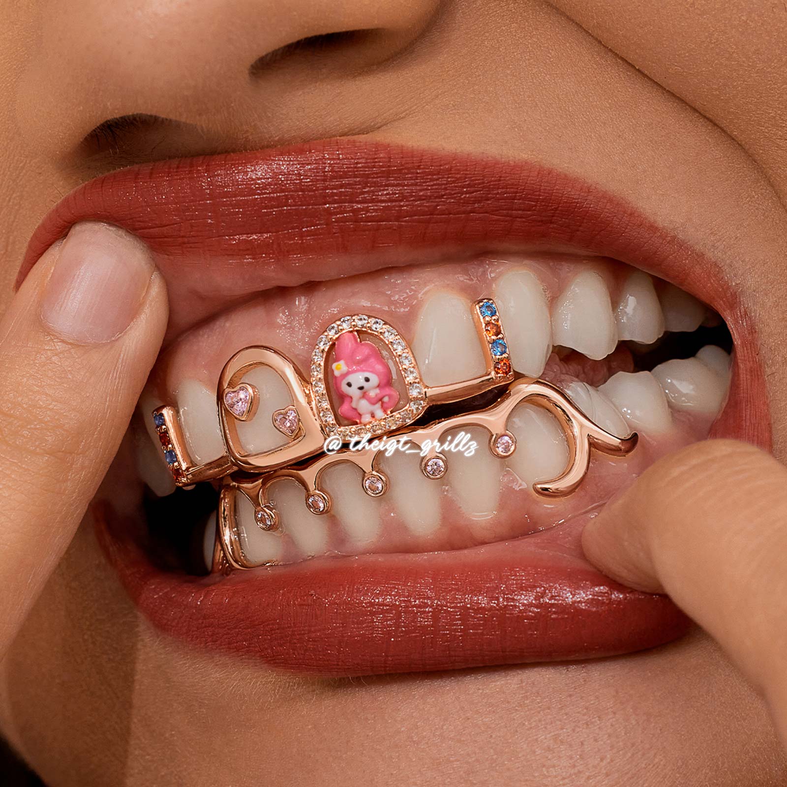 Pink Bunny Custom Grillz - Image 4