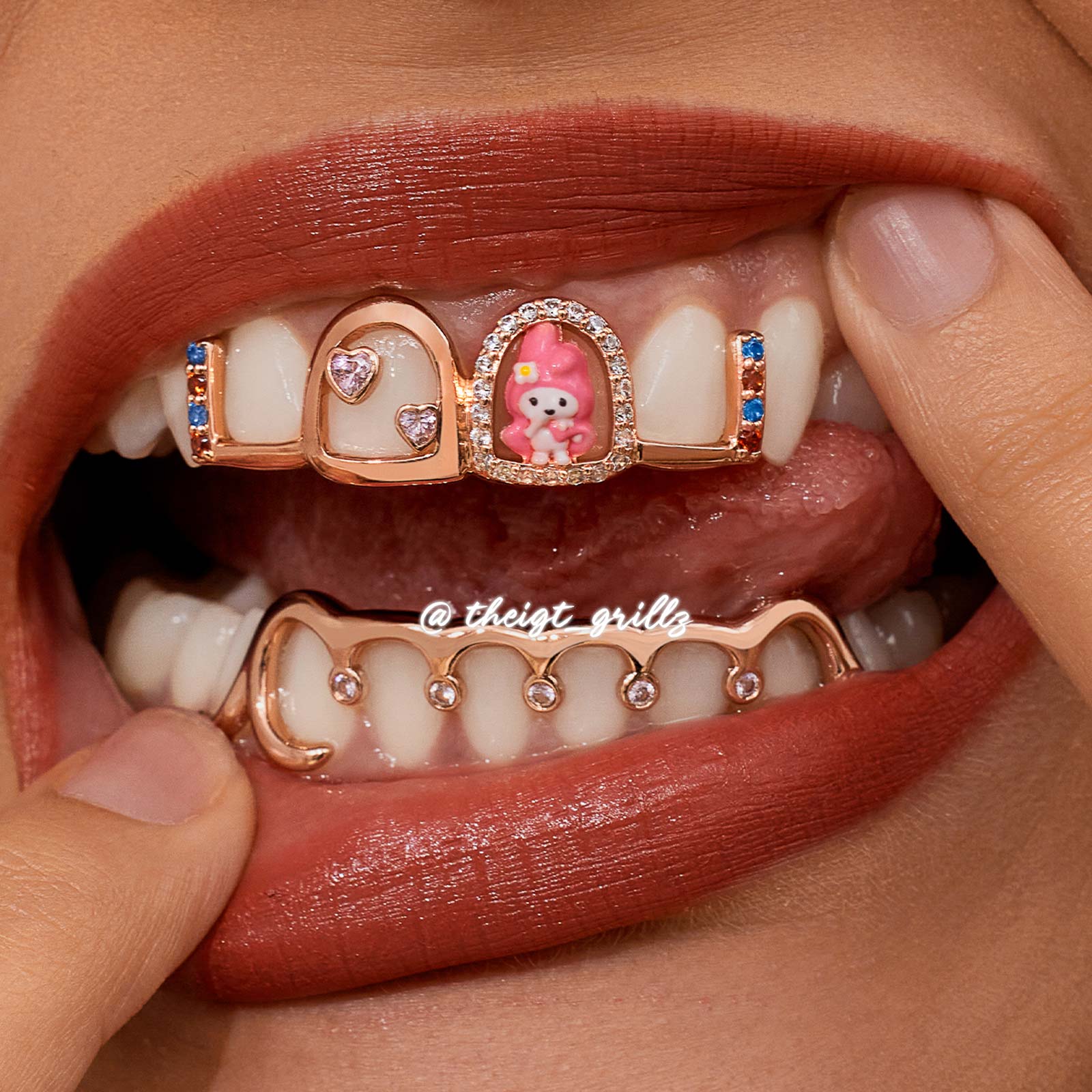 Pink Bunny Custom Grillz - Image 5