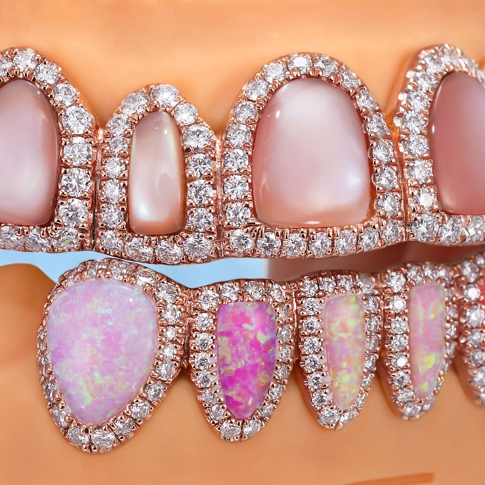 Pink Shell & Opal Diamond Grillz Set - Image 3