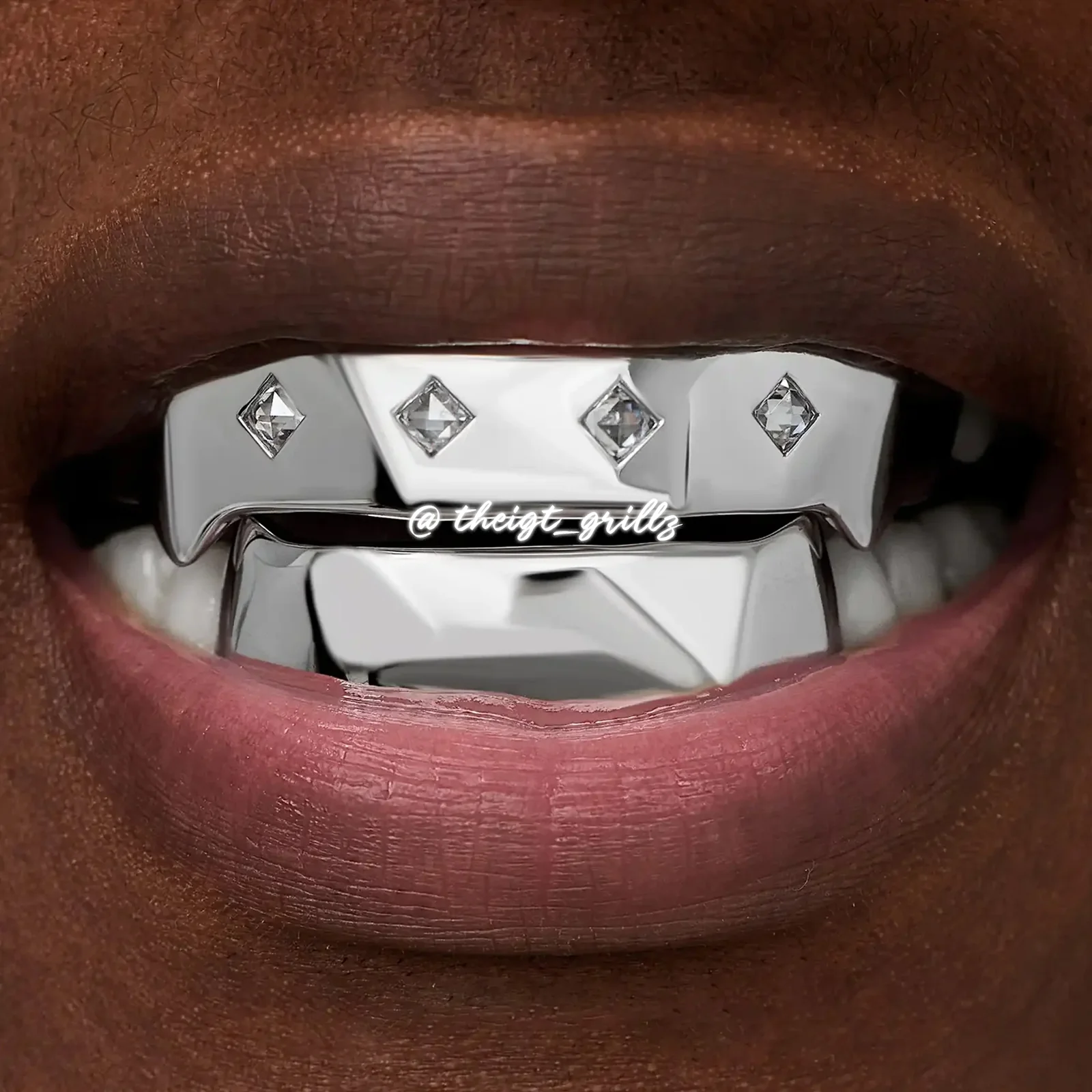 Platinum Ice Full-Cover Grillz - Image 4