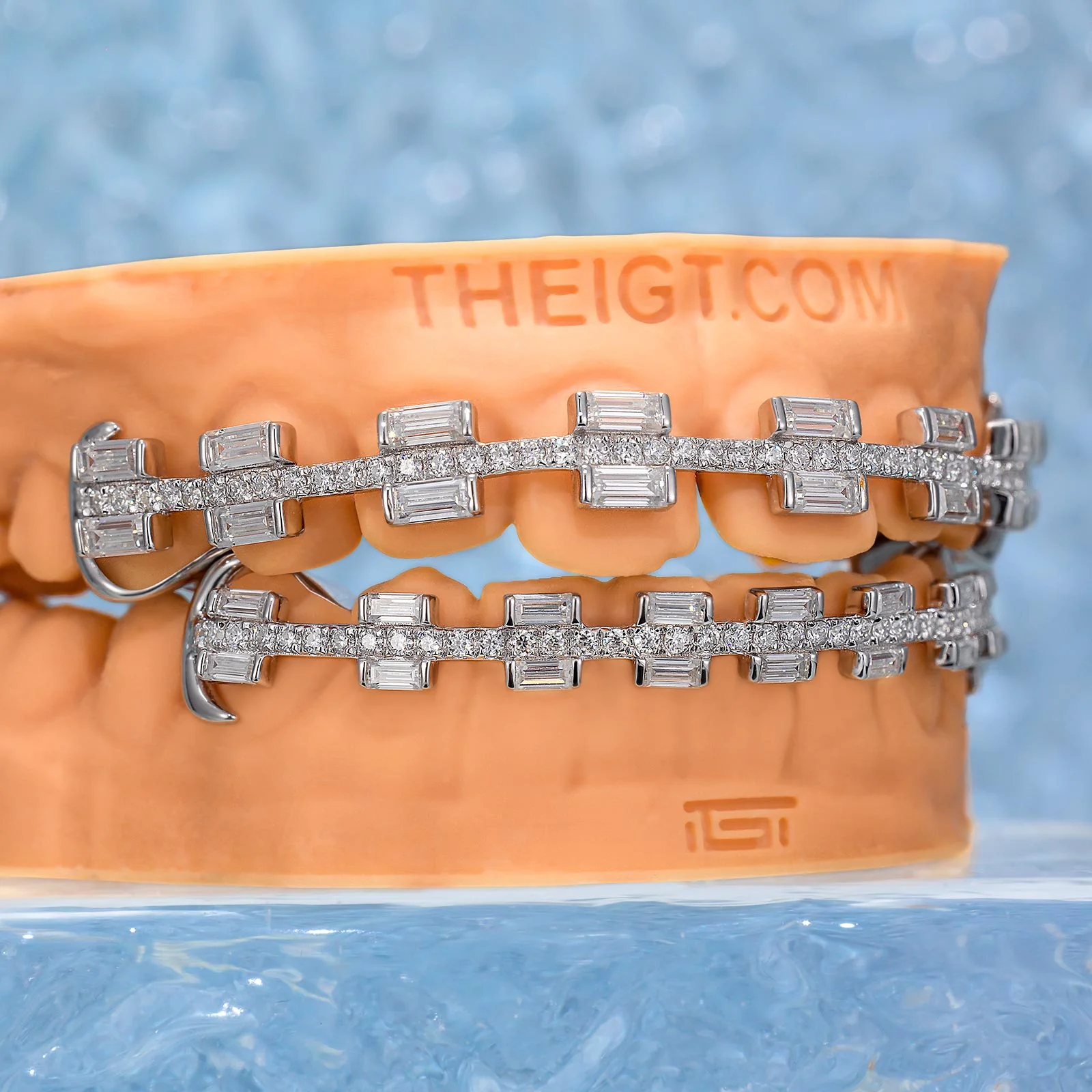 Rectangular Cut Brace Style Grillz - Image 3