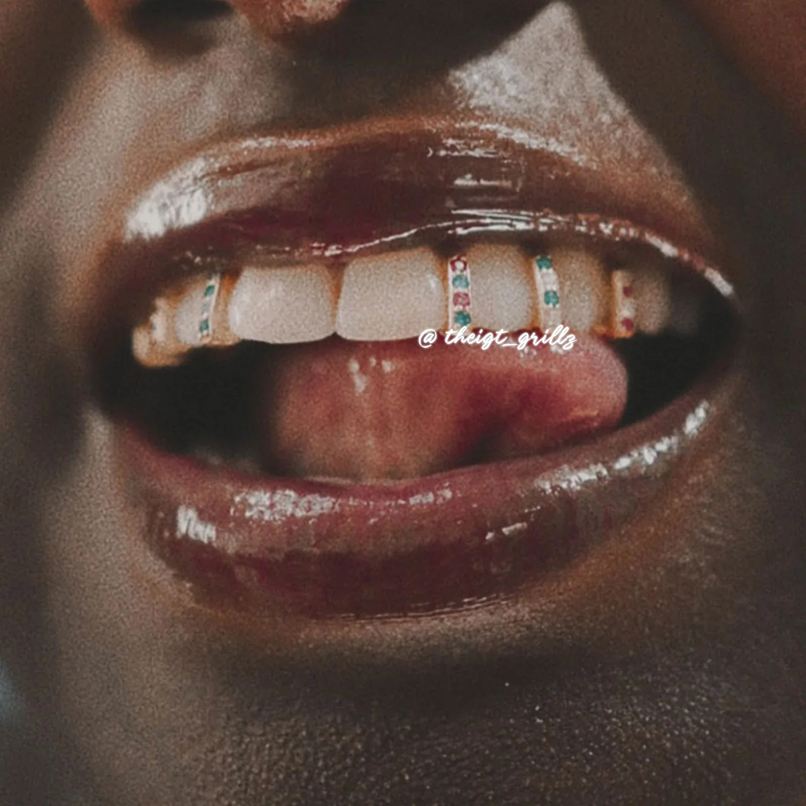 Single Row Diamond Bar Grillz - Image 10
