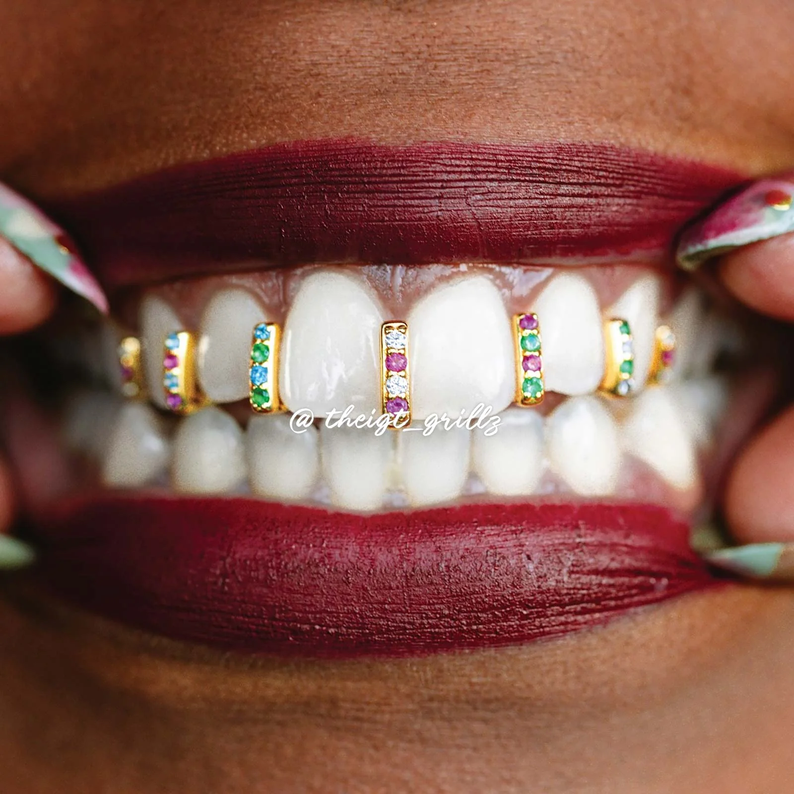 Single Row Diamond Bar Grillz - Image 7