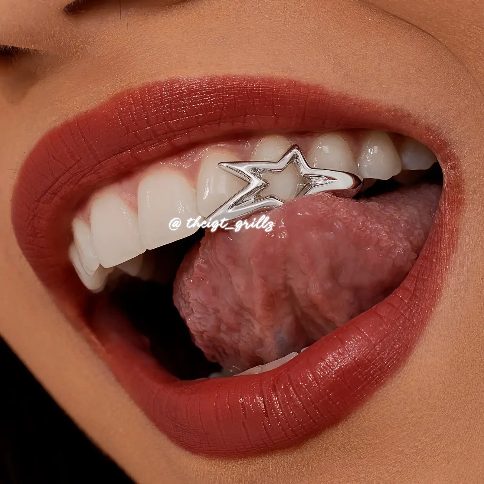 Star Grillz - Image 6