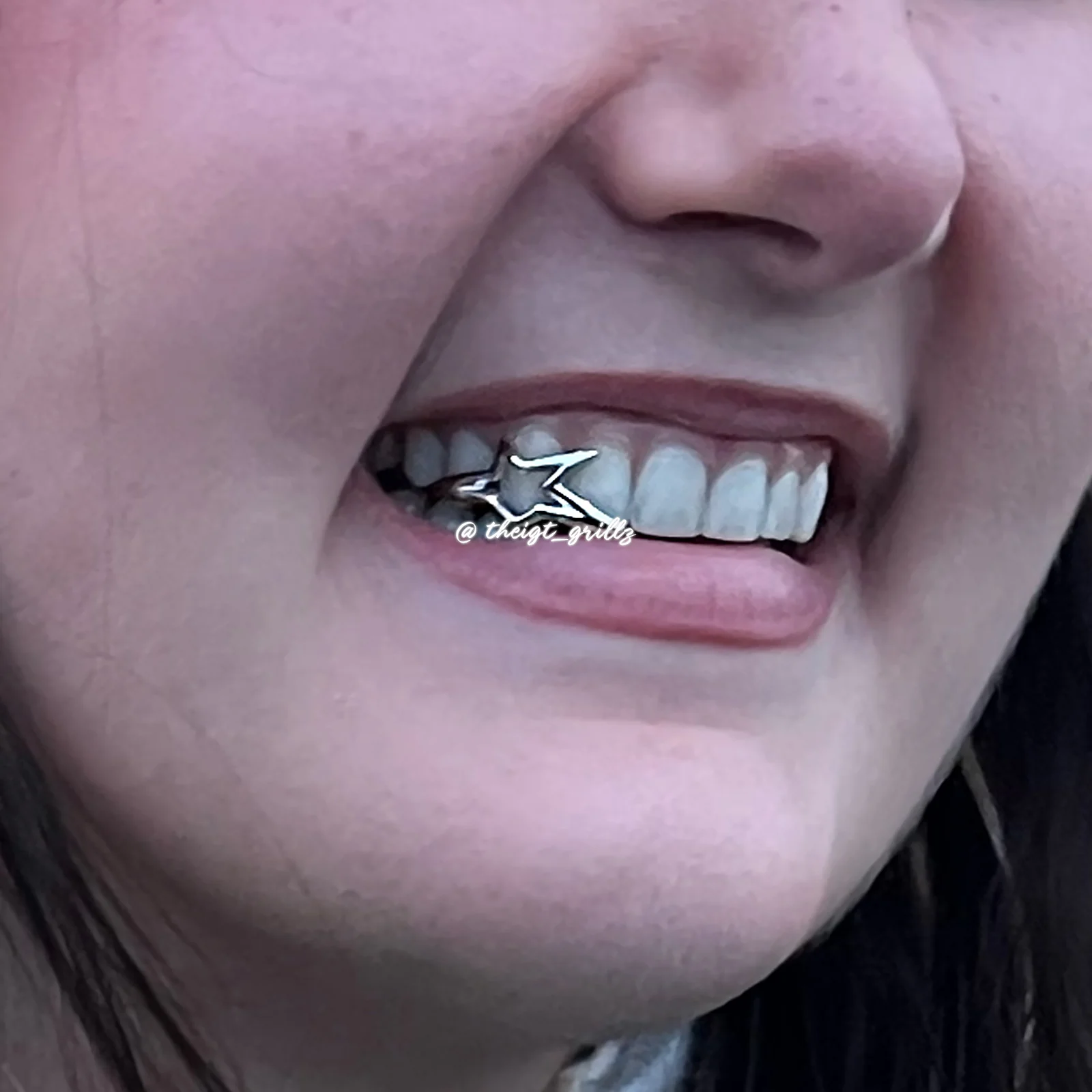 Star Grillz - Image 7