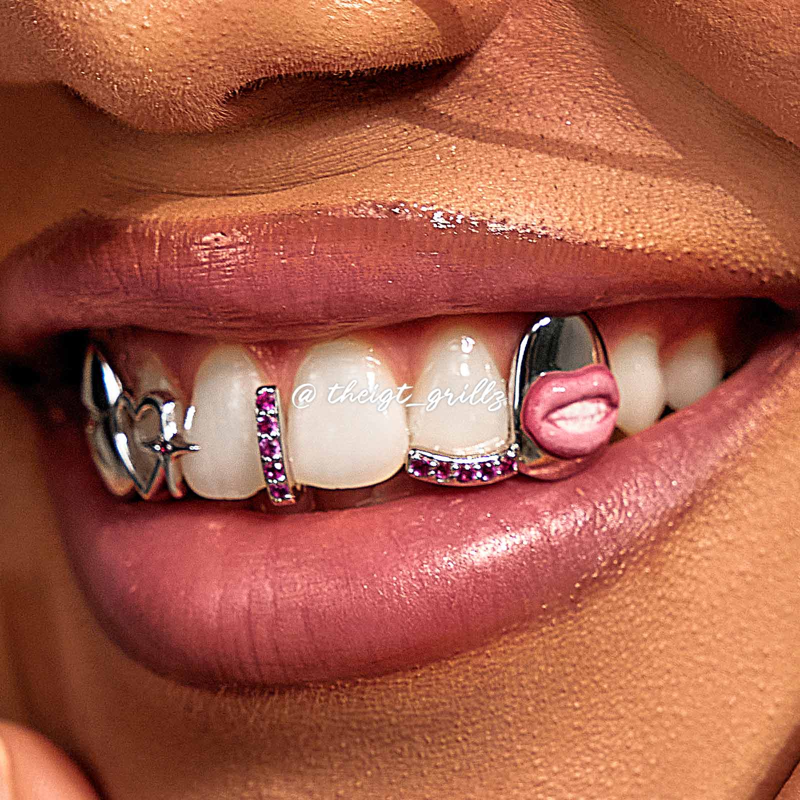 Star & Lip On Cap Grillz - Image 6
