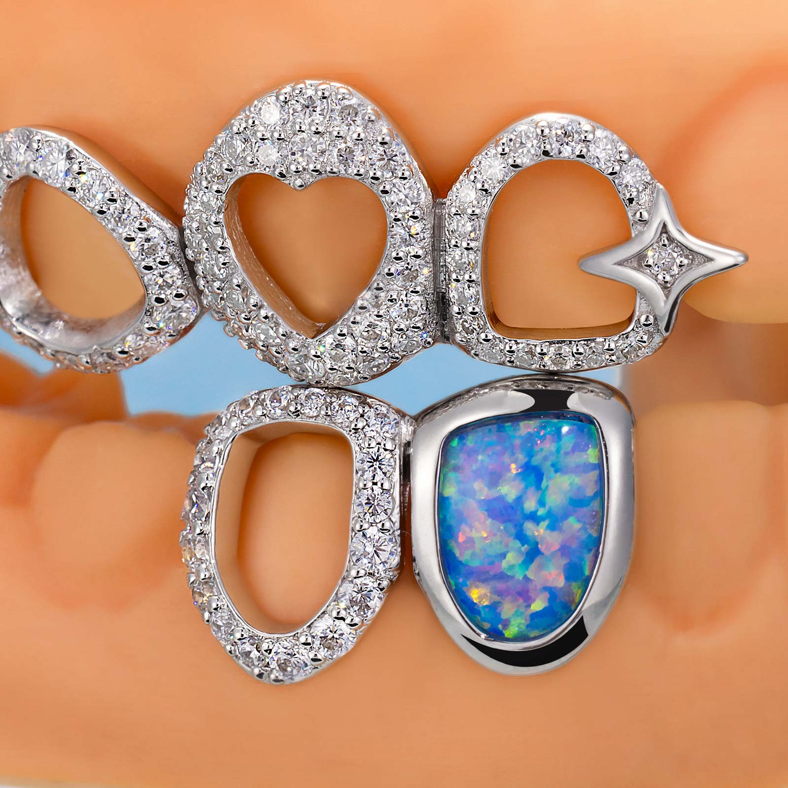 Star & Opal Diamond Grillz - Image 6