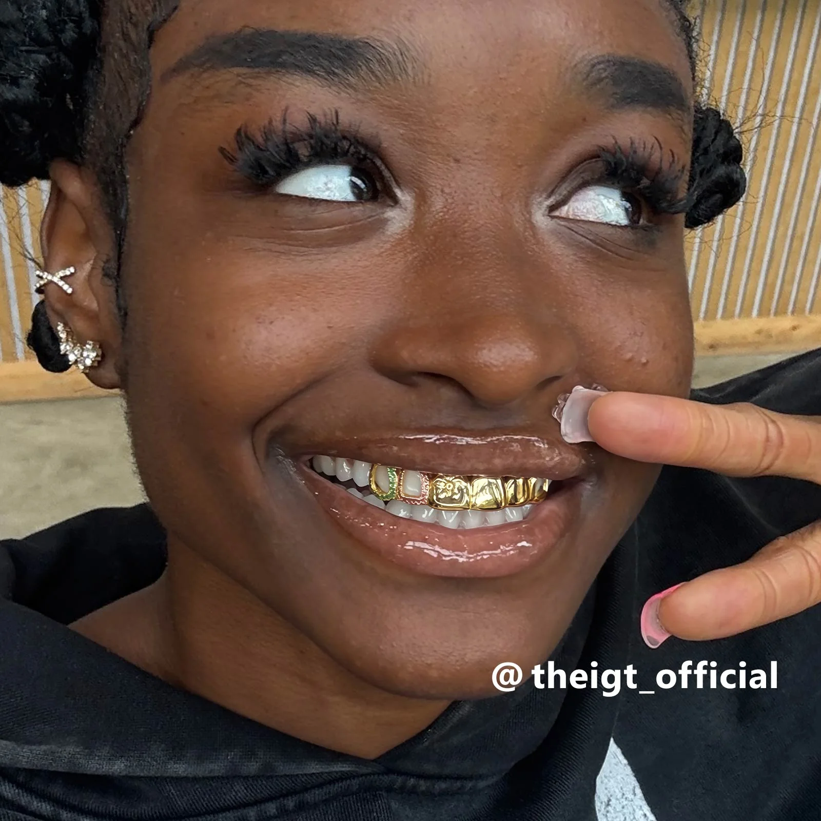 Top 6 Open Face Flower Grillz - Image 4