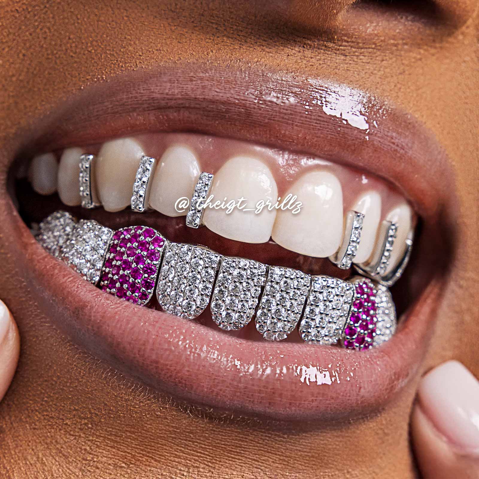 Top Iced Gap Bar & Bottom Pink Fang Grillz - Image 6