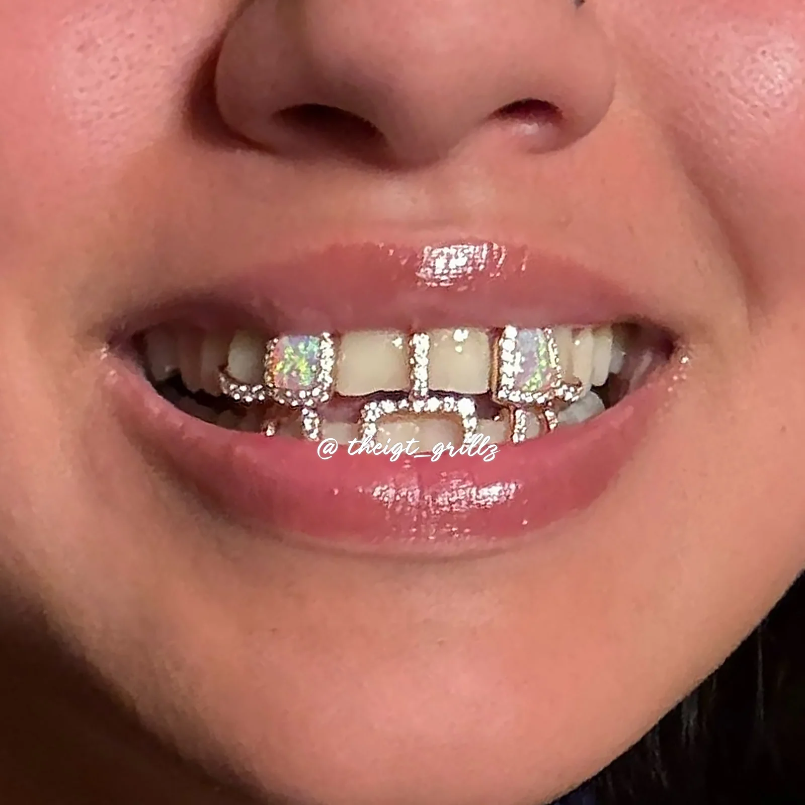 Top Opal W Bunny Tail Bar Grillz - Image 9