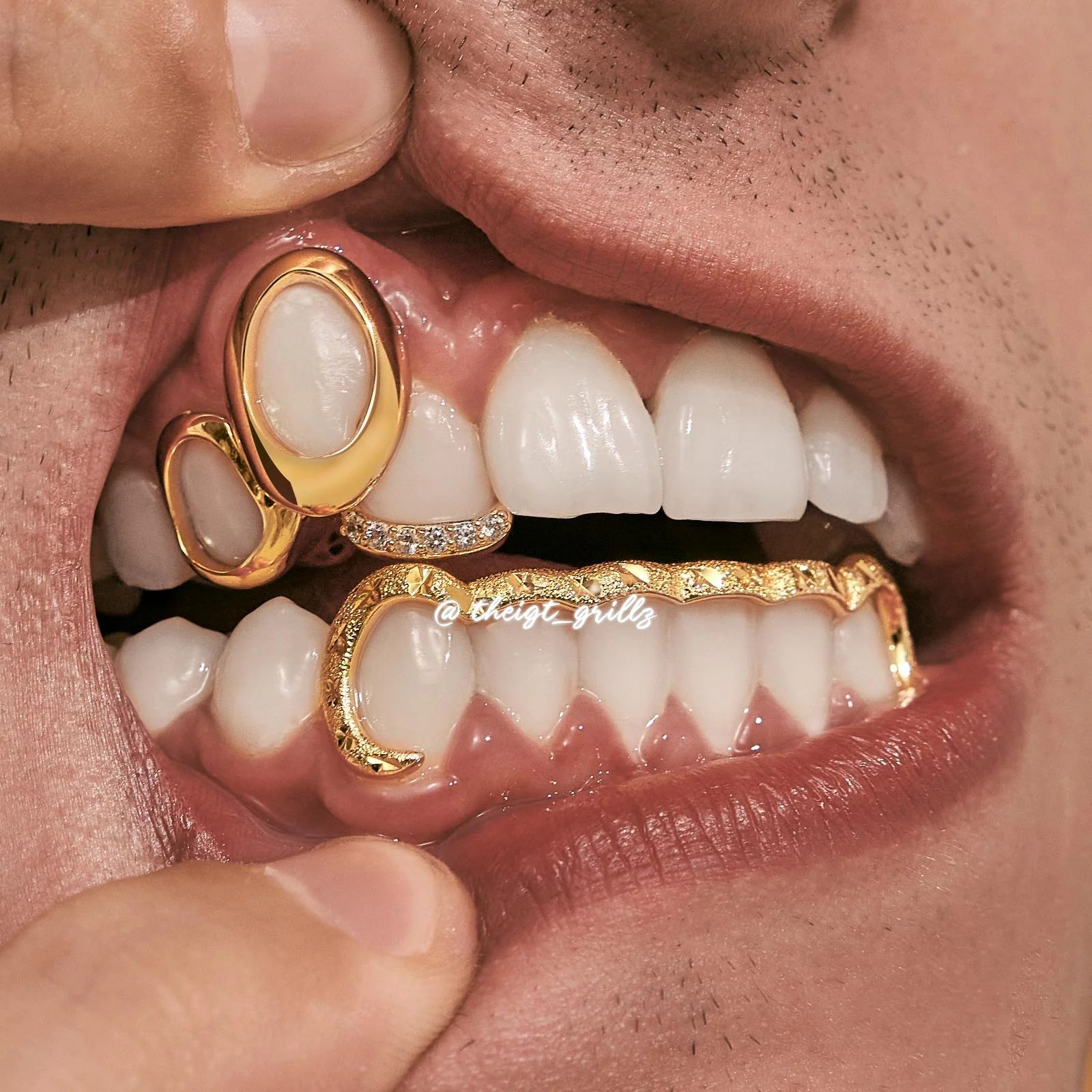 Top Open Face W Bottom Bar Grillz - Image 7