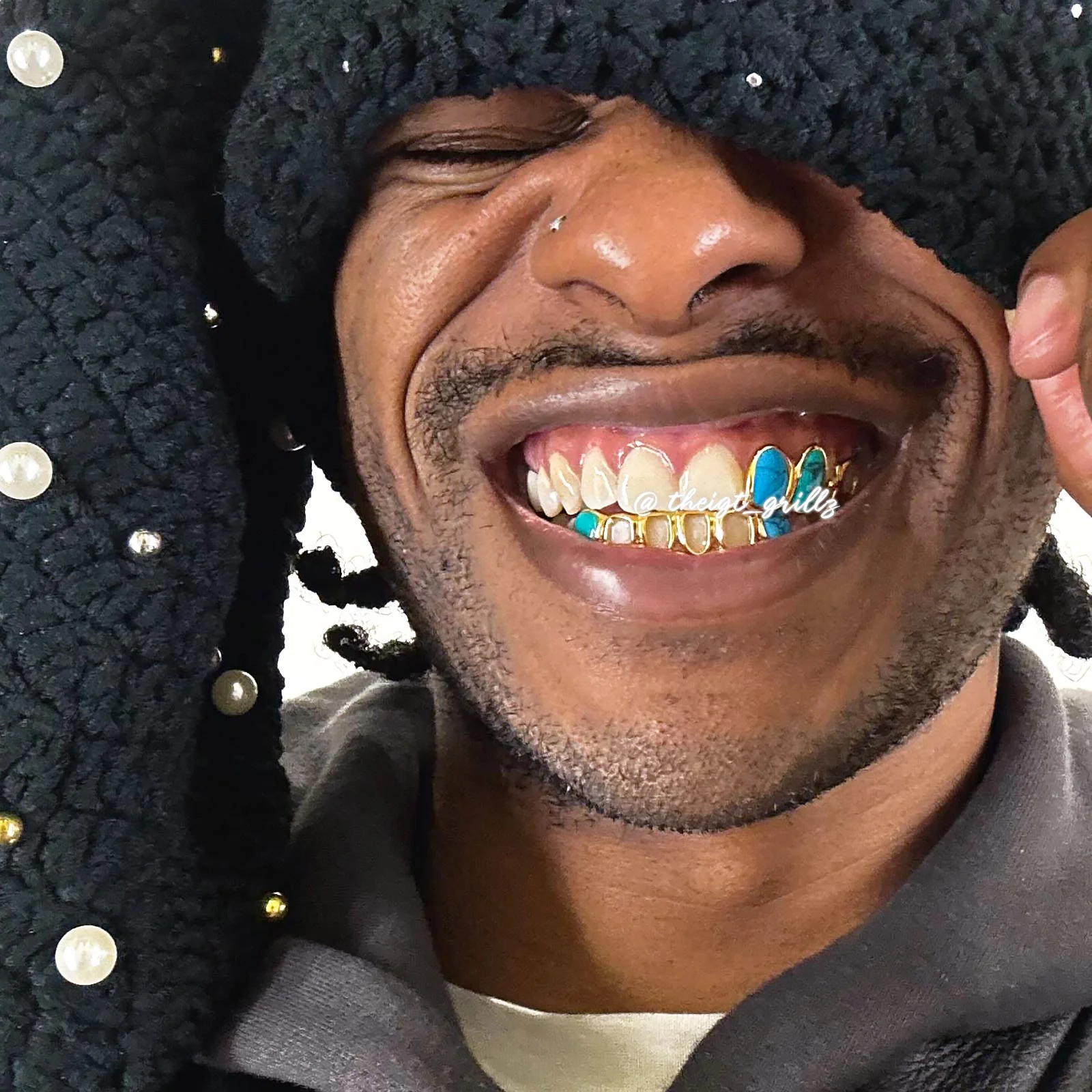 Turquoise & Open Face Grillz - Image 9