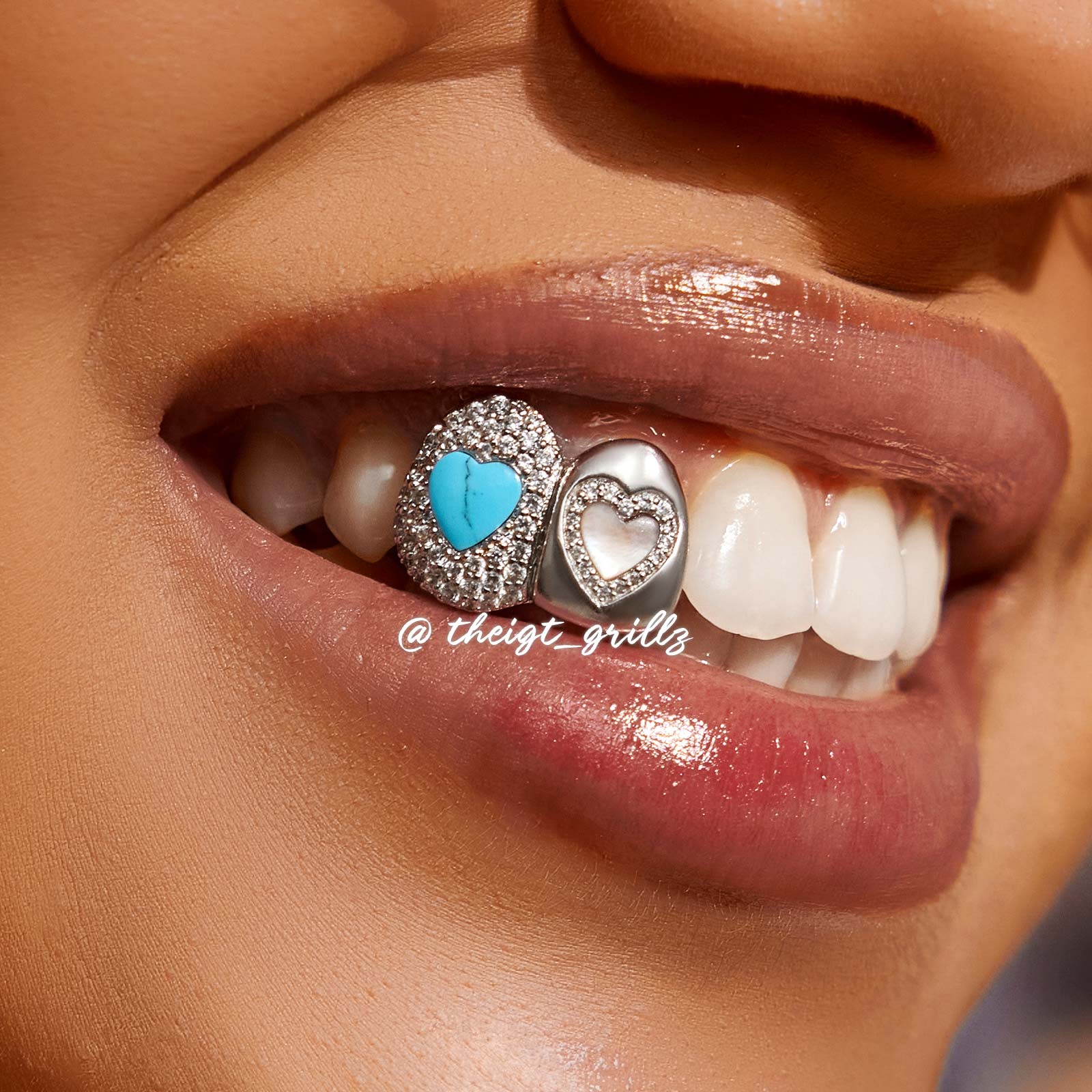 Turquoise & Pink Shell On Cap Grillz - Image 5