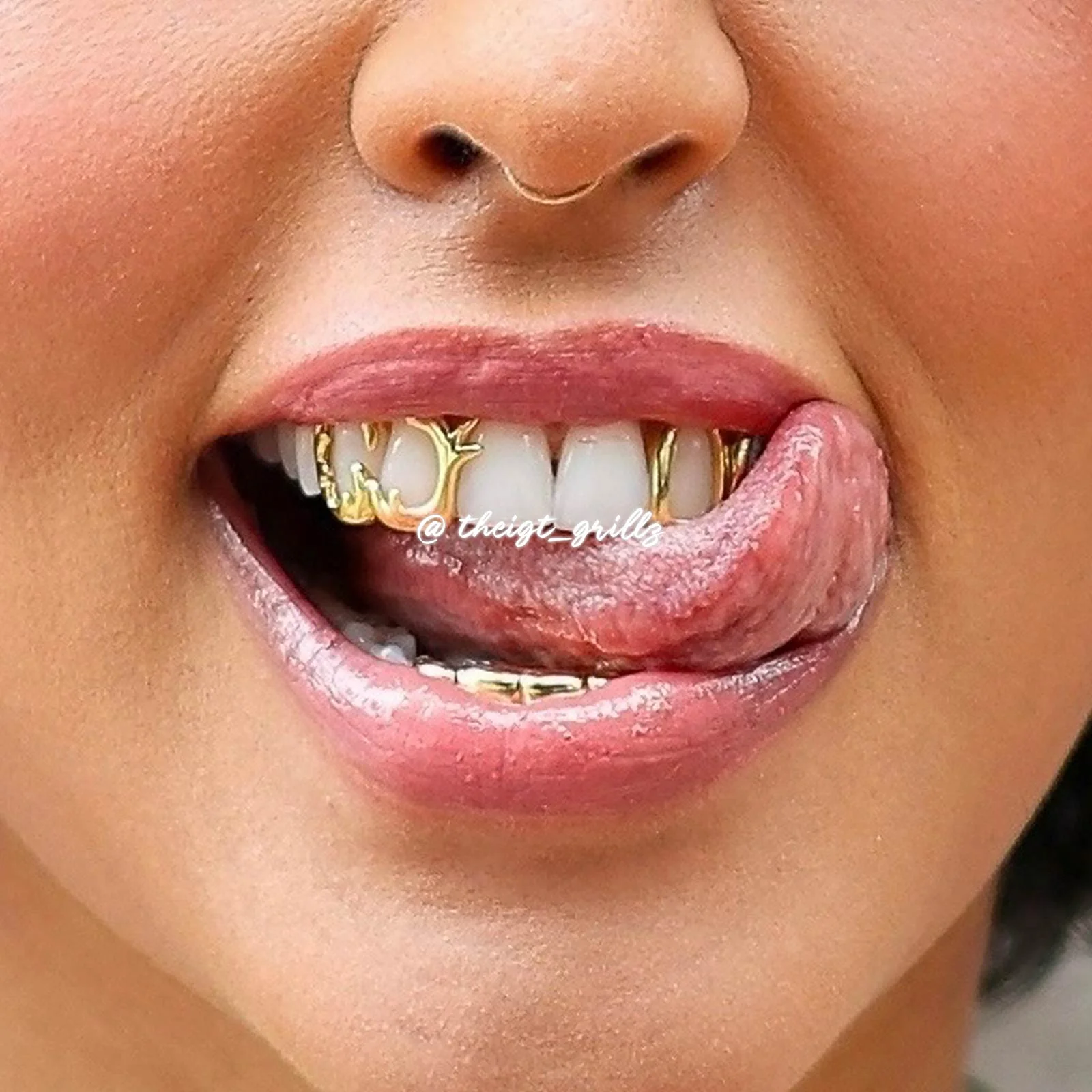 Wave & Opal Style Grillz - Image 12