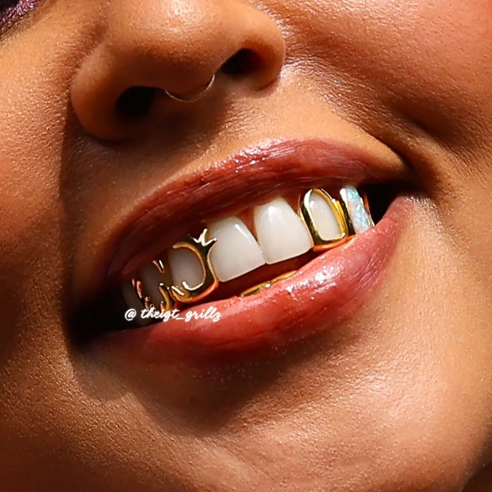 Wave & Opal Style Grillz - Image 13