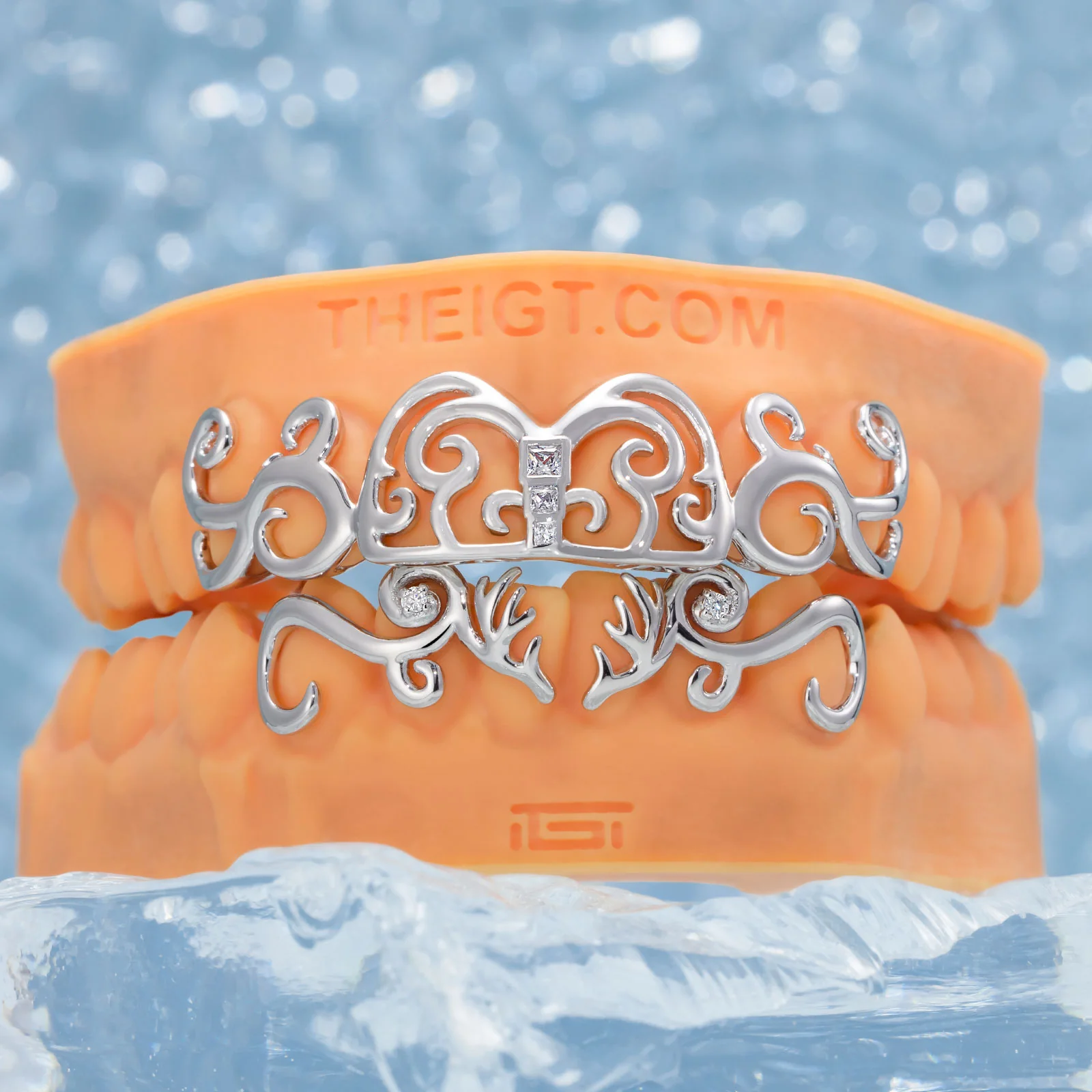 Whimsy Deer Grillz