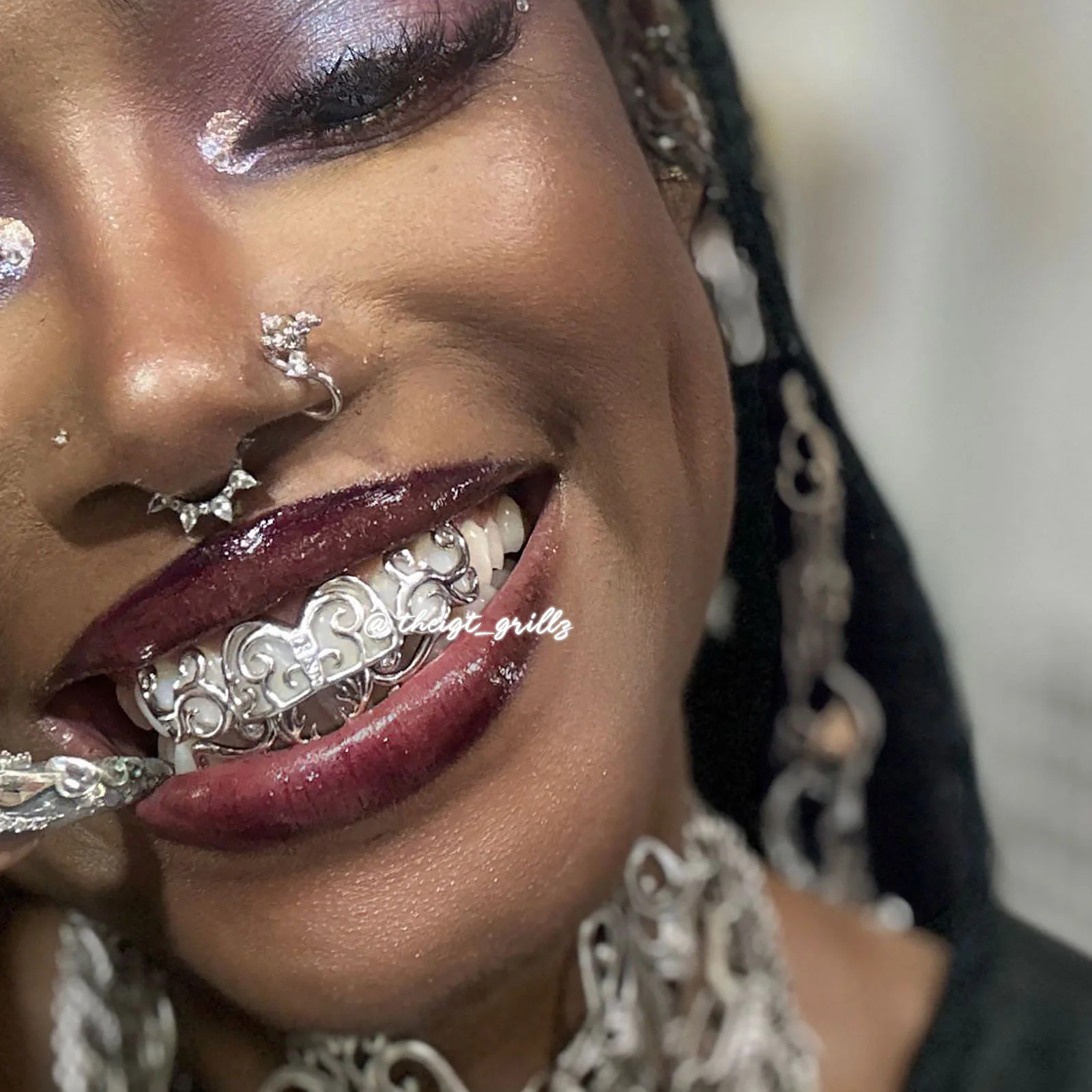 Whimsy Deer Grillz - Image 8