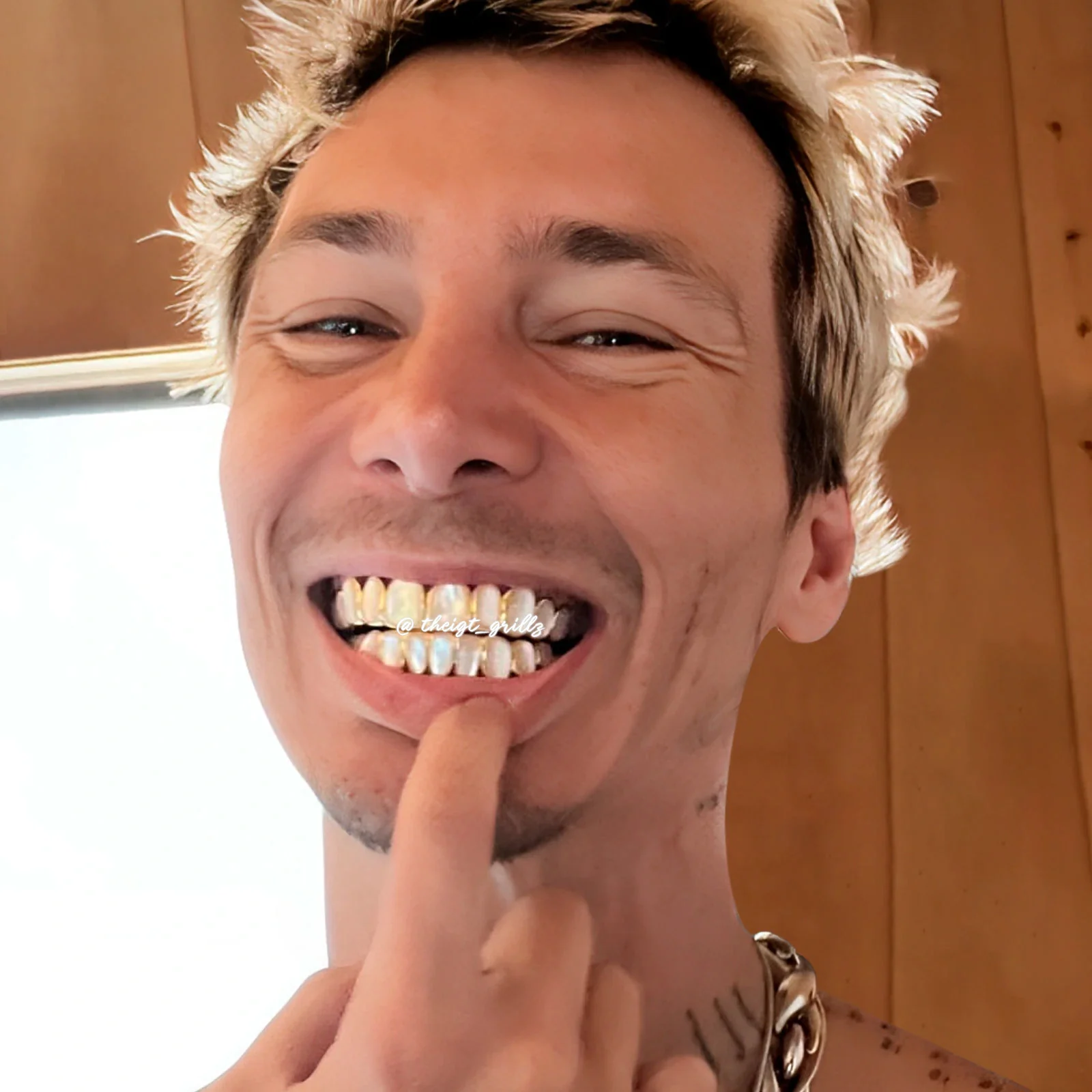 White Shell Grillz - Image 10