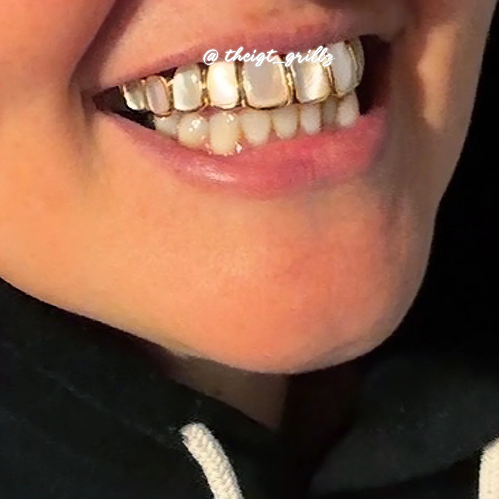 White Shell Grillz - Image 9